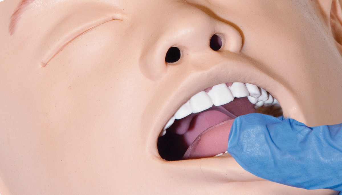 SimJunior_TongueEdema2.jpg